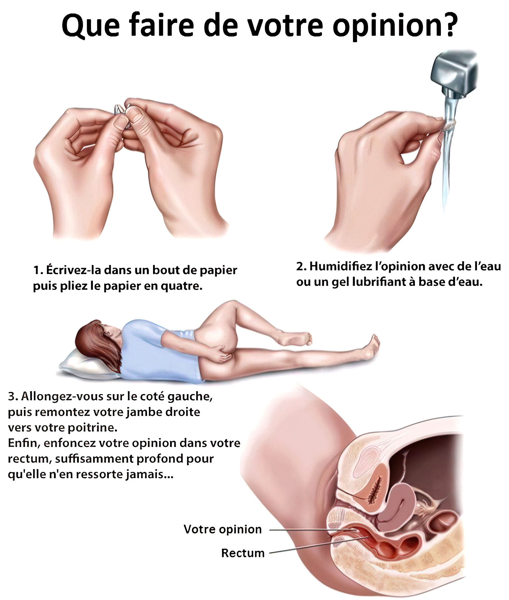 Que faire de votre opinion