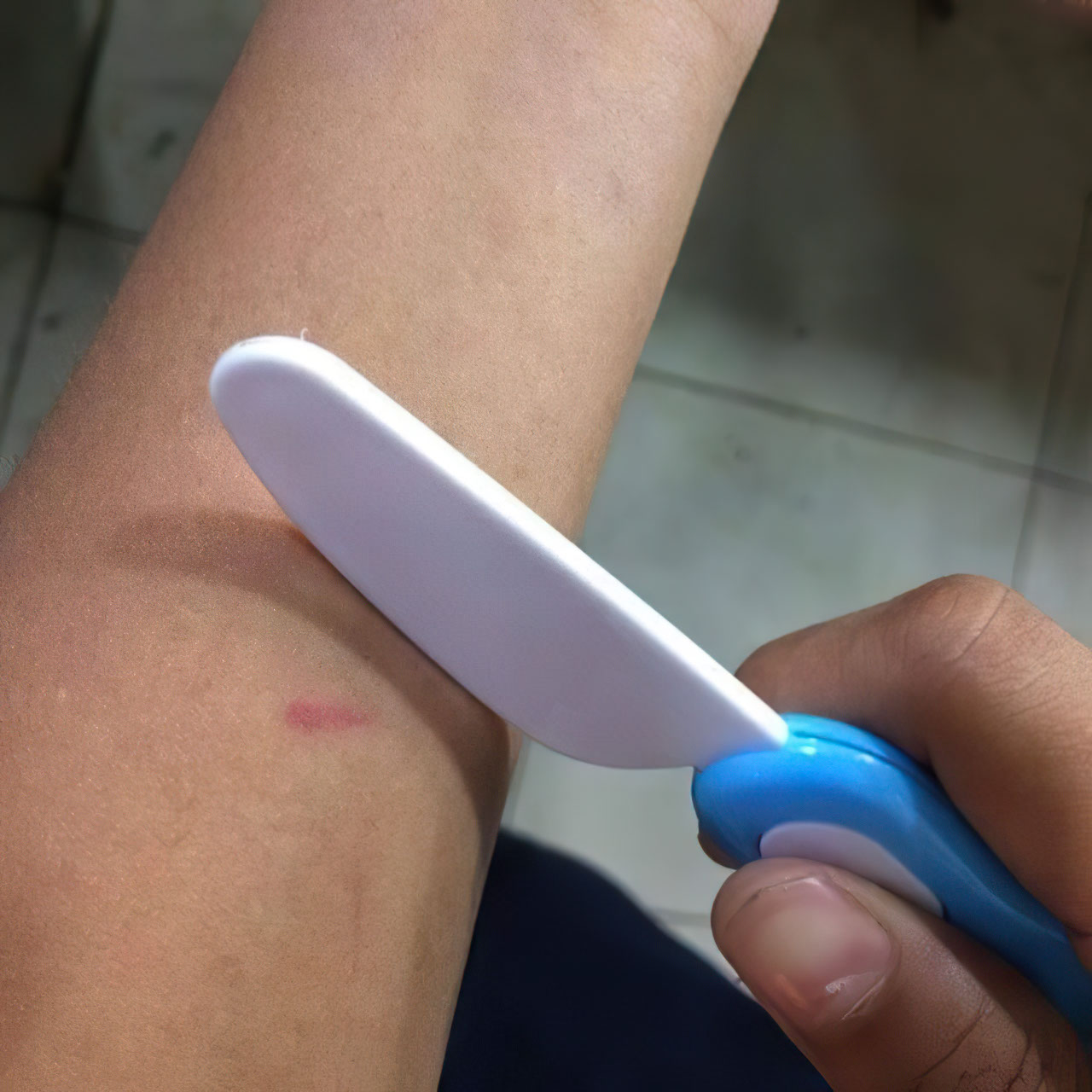 Soft mutilation