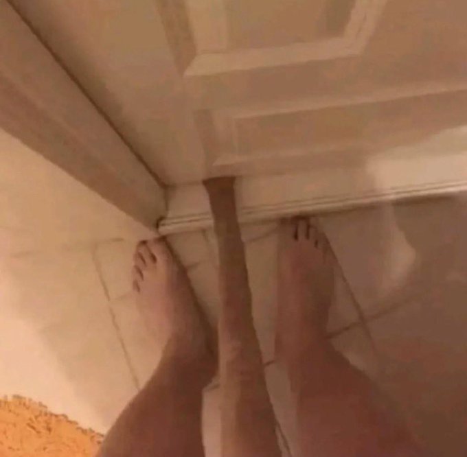 prépuce coincé porte pénis zizi zgeg