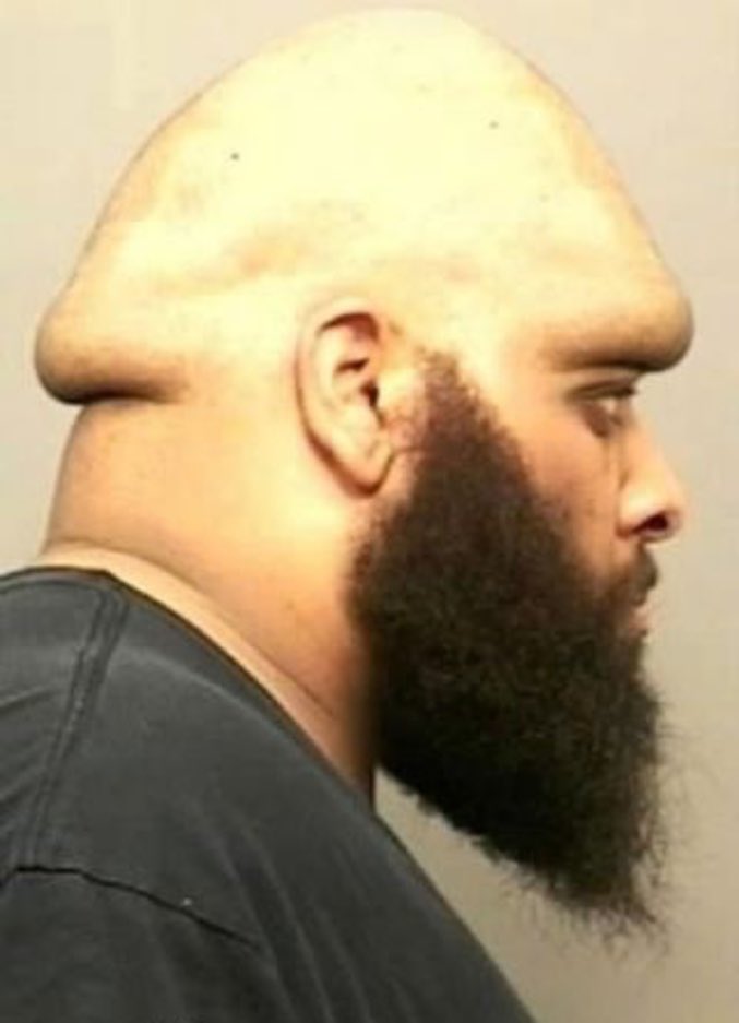 Homme avec crâne en forme de bite/gland