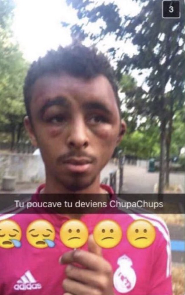 tu poucave tu deviens ChupaChups
