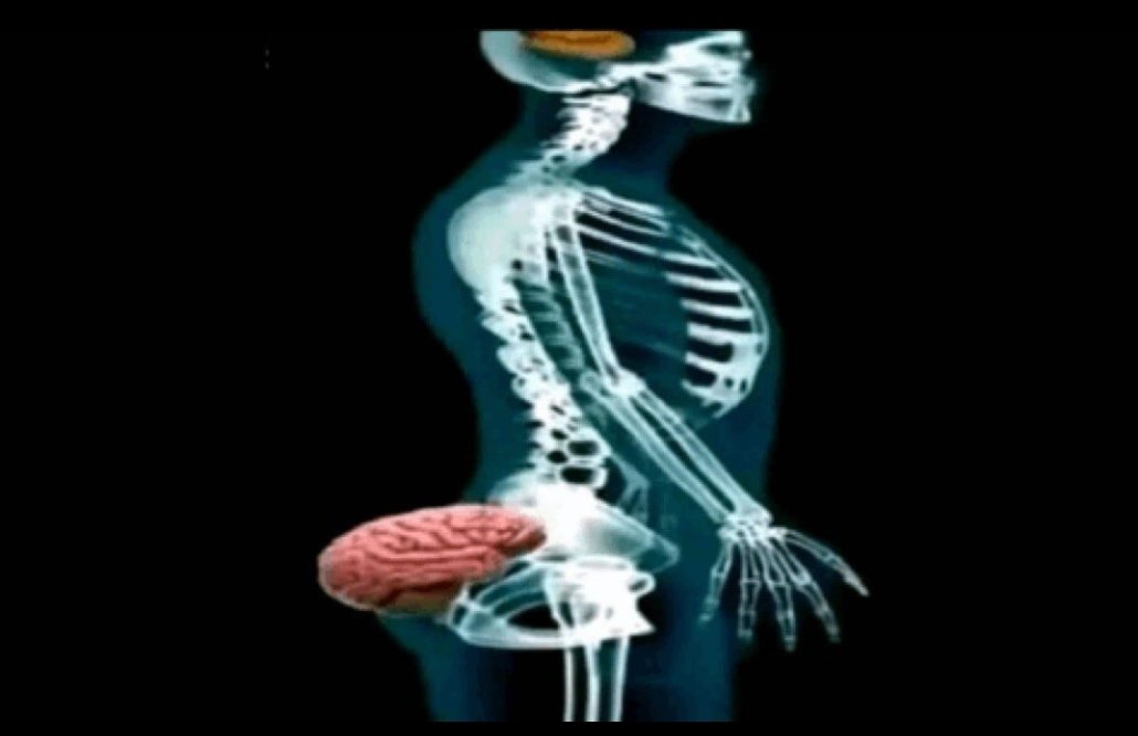 Squelette avec le cerveau dans les fesses